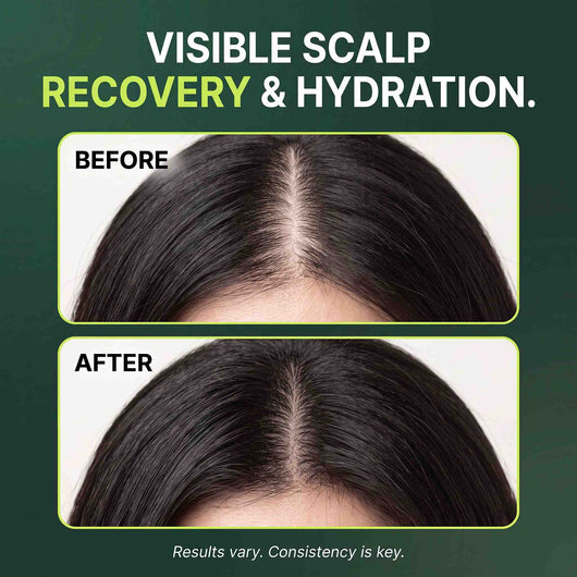 Korean Scalp Care Shampoo Bar